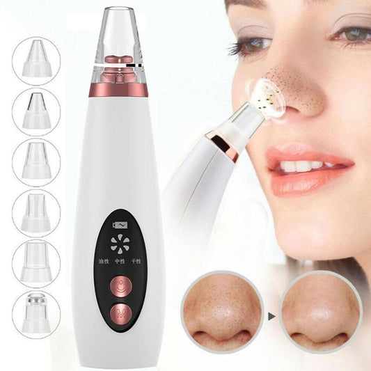 Blackhead Pore Vacuum Cleaner Nose Cleanser Blackheads Remover Blackhead Acne Removal Button Face Suction Beauty Skin Care Tool ShoppingLife.site